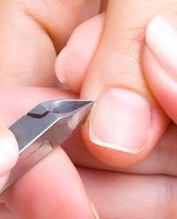 Burrs nos dedos: causas e tratamento