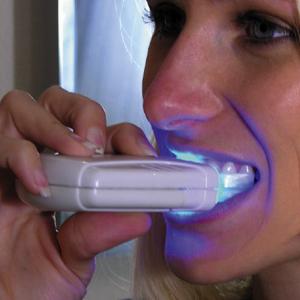 Que dentes branquear em casa e quão eficaz é?